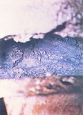 Washout Zone in the Waste Handling Shaft